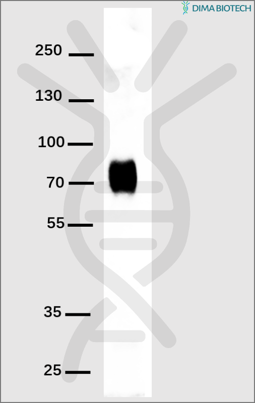antibody-DME100001 His Fig1