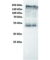 antibody-dmc100120 ceacam5 wb1 1