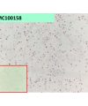 antibody-dmc100158 axl ihc1