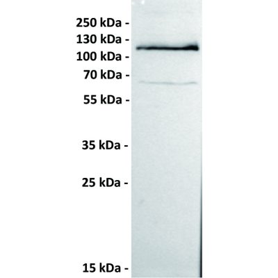 antibody-dmc100228 ror1 wb1 1