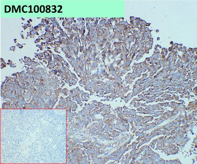 antibody-dmc100832 adam9 ihc1