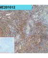 antibody-dme201012 ceacam5 ihc1