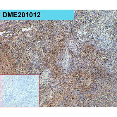 antibody-dme201012 ceacam5 ihc1