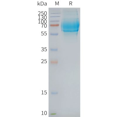 page-FLP100085 GCGR Fig.2 SDS PAGE 1