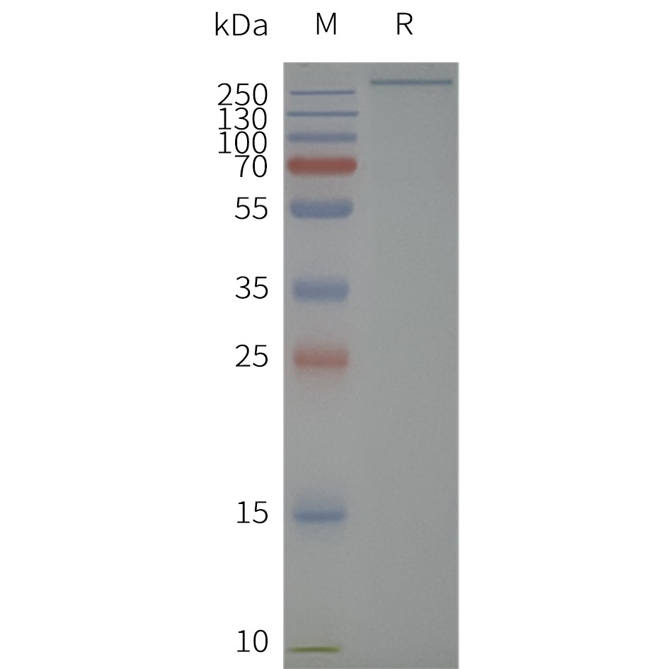 flp100726-scn5a-sp1.jpg