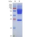 page-flp120175 ackr1 strep sp1