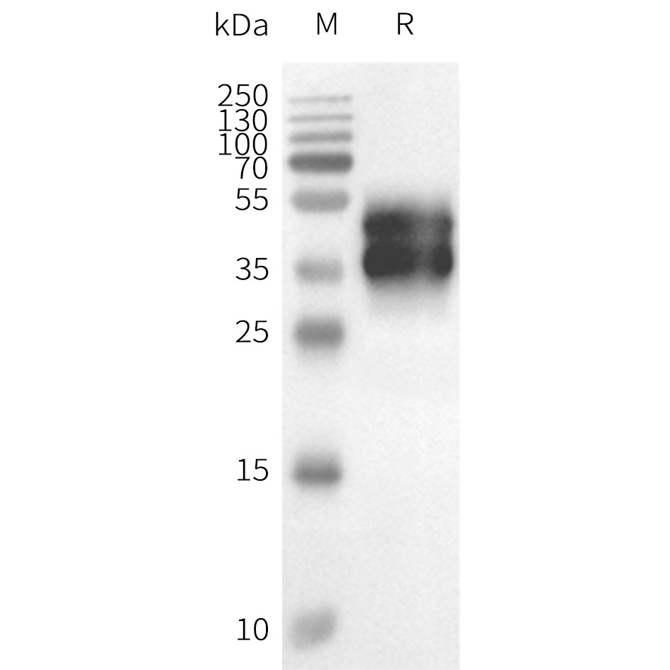 flp120313-gpr6-strep-sp1.jpg