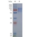 page-flp120500 gpr161 strep sp1