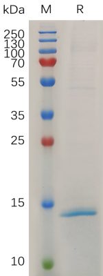 sp-PME M100032 RNASE4 His PAGE 300