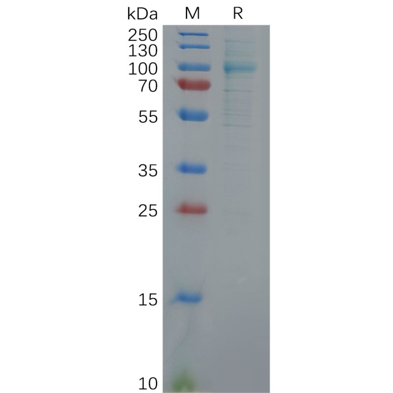 Human FAP (30-760) Protein, His Tag - DIMA Biotechnology