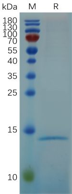 sp-PME100678 RNASE4 His PAGE 300