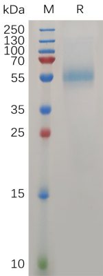 sp-PME100733 ZP3 Protein His PAGE 300