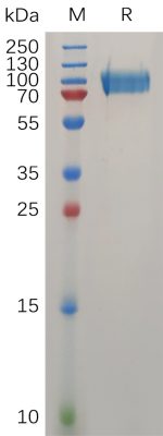 sp-PME100735 MUC18 Protein His PAGE 300