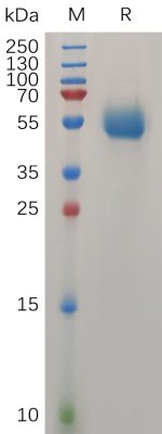 sp-PME100739 IL31 Protein hFc PAGE 300