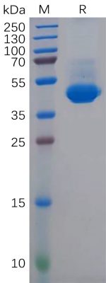 sp-PME100874 NECTIN 4 His 300