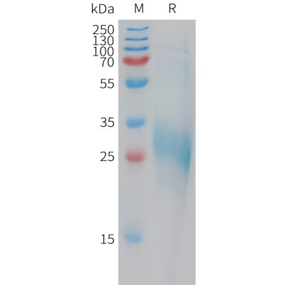 sp-PME101203 CLEC1B Fig.1 SDS PAGE 1