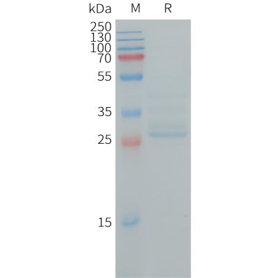 sp-PME101249 NINJ1 Fig.1 SDS PAGE 1