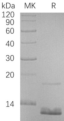 sp-PME30018 CF38 P55774 SDS PAGE 0