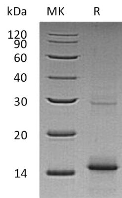 sp-PME30039 CR36 P43026 SDS PAGE 0