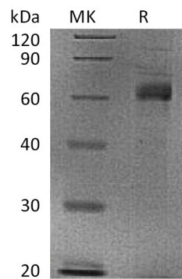 sp-PME30043 CA48 Q13253 SDS PAGE 0