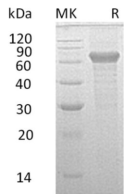 sp-PME30051 CC41 Q6UXL0 SDS PAGE 0