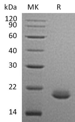 sp-PME30067 CR11 O15520 SDS PAGE 0