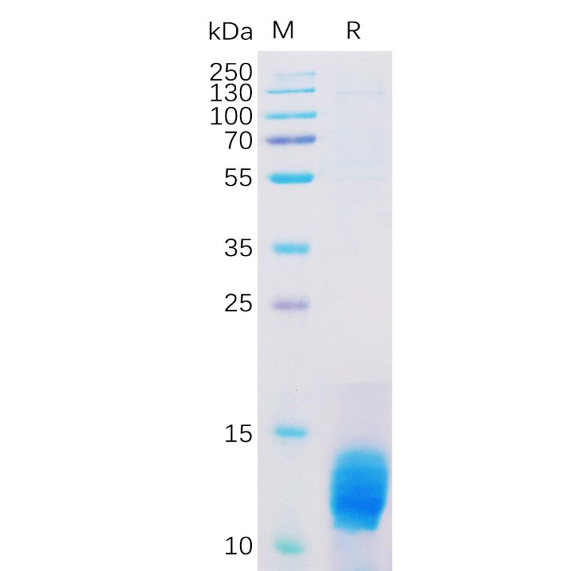 Human MUC1 Protein, HisTag - DIMA Biotechnology