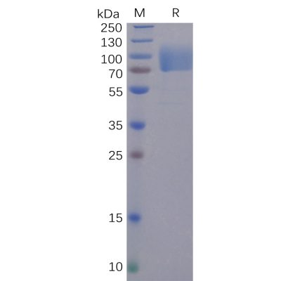 sp-pme100493 s1 protein ntd sp1