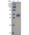 sp-pme100647 s protein rbd sp1