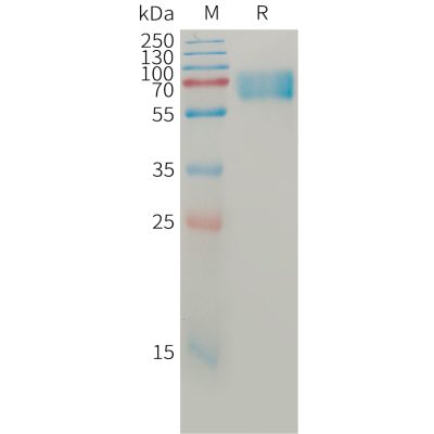 sp-pme101214 bace1 sp1
