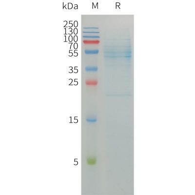sp-pme101215 selenop sp1