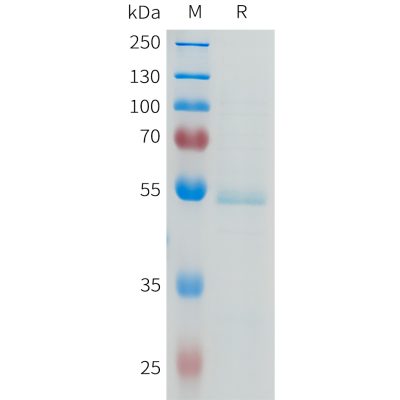 sp-pme101636 ror2 sp1