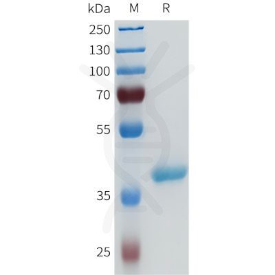 sp-pme101687 enpp3 sp1