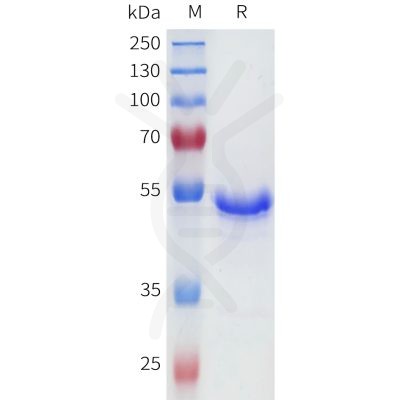 sp-pme101696 ca9 sp1