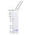 sp-pme101731 sortase a sp1